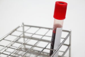 Blood in Test Tube