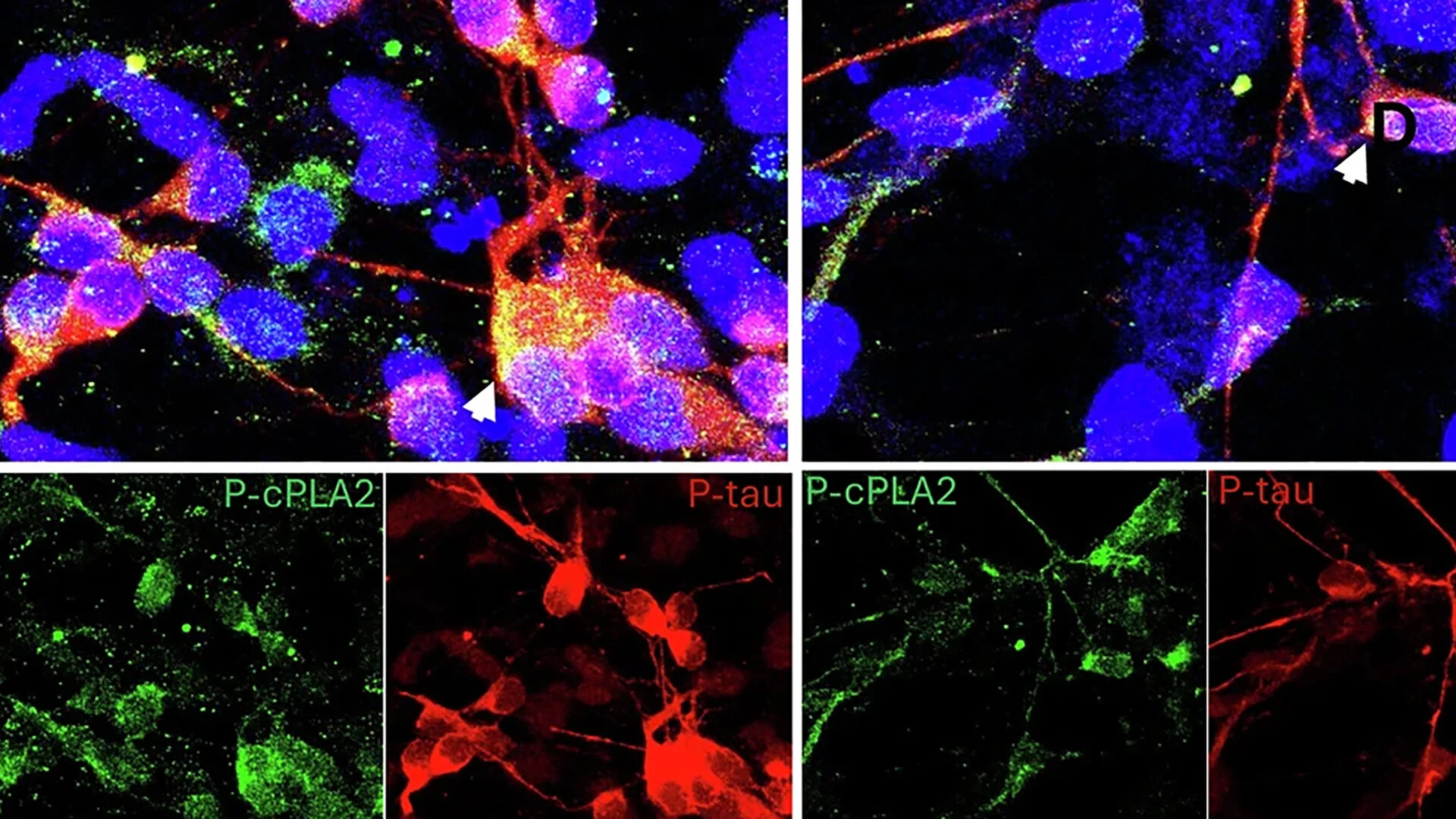 USC Scientists Identify Promising New Target for Alzheimer's